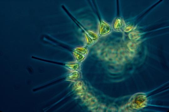 2400x1684-chain-forming-diatom.jpg